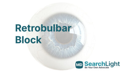 Retrobulbar Block