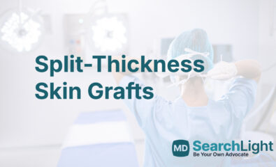 Split-Thickness Skin Grafts