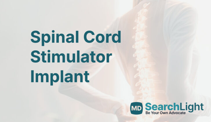 Spinal Cord Stimulator Implant