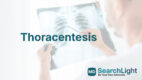 Thoracentesis