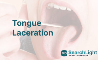 Tongue Laceration