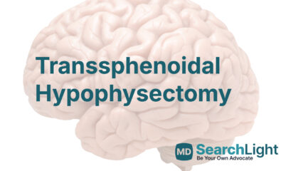Transsphenoidal Hypophysectomy