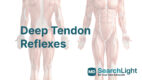Deep Tendon Reflexes