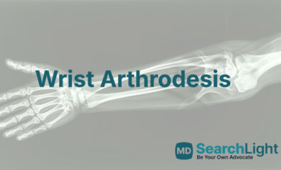 Wrist Arthrodesis
