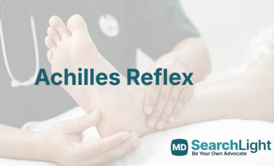 Achilles Reflex