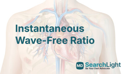 Instantaneous Wave-Free Ratio