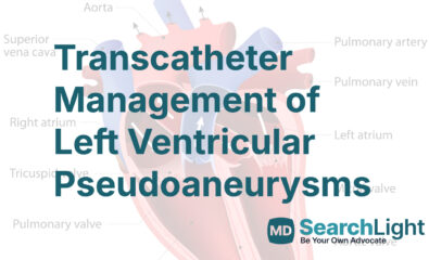 Transcatheter Management of Left Ventricular Pseudoaneurysms