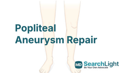 Popliteal Aneurysm Repair