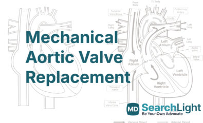 Mechanical Aortic Valve Replacement