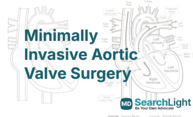 Minimally Invasive Aortic Valve Surgery
