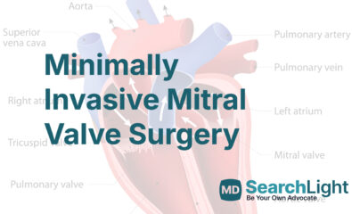 Minimally Invasive Mitral Valve Surgery
