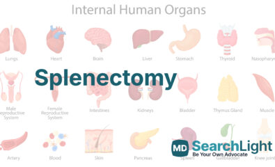 Splenectomy