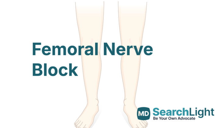 Femoral Nerve Block