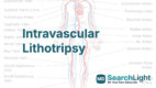 Intravascular Lithotripsy