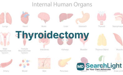 Thyroidectomy