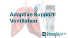 Adaptive Support Ventilation
