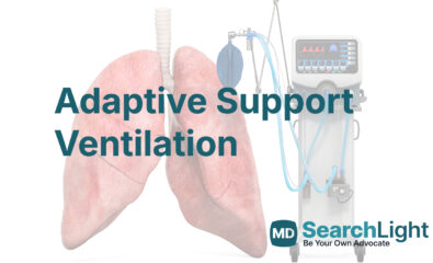 Adaptive Support Ventilation