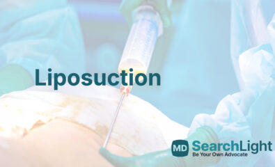 Liposuction
