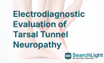 Electrodiagnostic Evaluation of Tarsal Tunnel Neuropathy