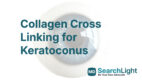 Collagen Cross Linking for Keratoconus