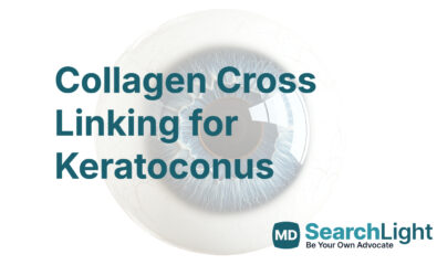 Collagen Cross Linking for Keratoconus