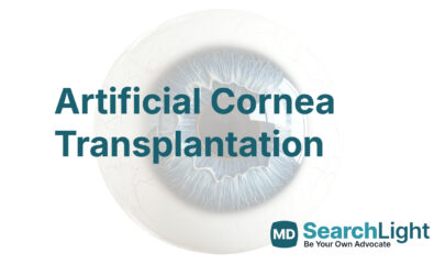 Artificial Cornea Transplantation