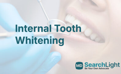 Internal Tooth Whitening