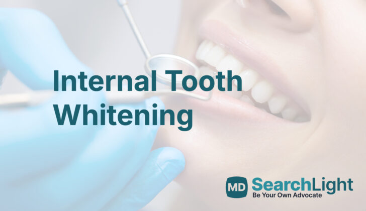 Internal Tooth Whitening