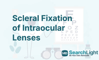 Scleral Fixation of Intraocular Lenses