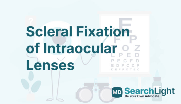 Scleral Fixation of Intraocular Lenses
