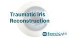 Traumatic Iris Reconstruction