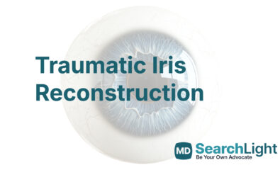 Traumatic Iris Reconstruction