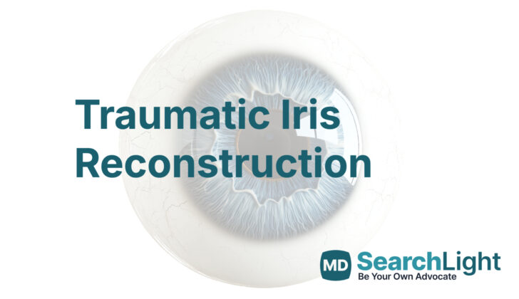 Traumatic Iris Reconstruction
