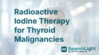 Radioactive Iodine Therapy for Thyroid Malignancies