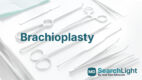 Brachioplasty