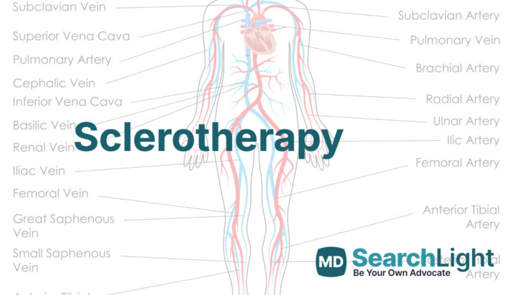Sclerotherapy