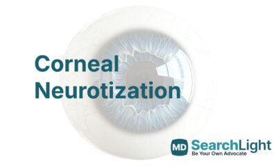 Corneal Neurotization