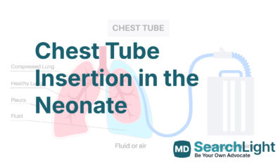 Chest Tube Insertion in the Neonate