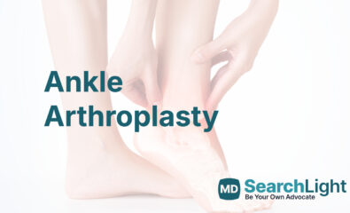 Ankle Arthroplasty