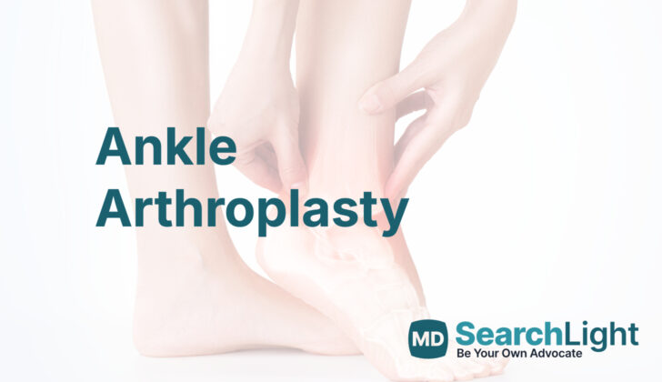 Ankle Arthroplasty