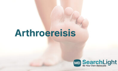 Arthroereisis