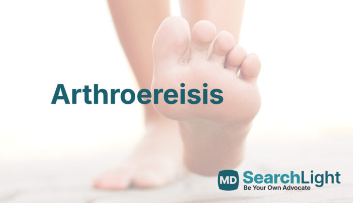 Arthroereisis