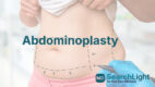 Abdominoplasty
