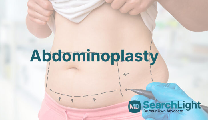 Abdominoplasty