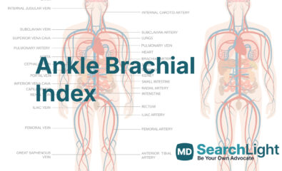 Ankle Brachial Index