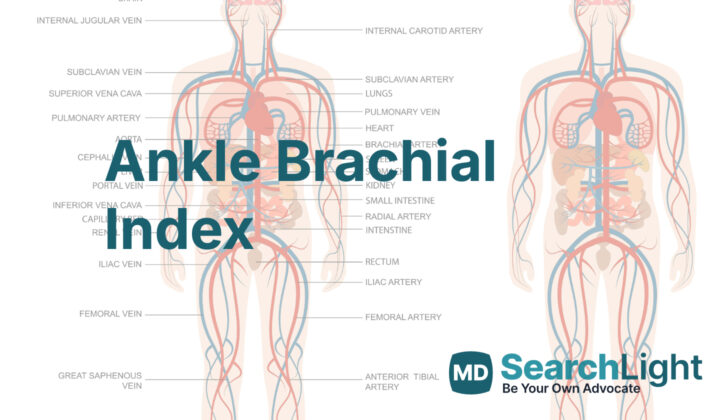 Ankle Brachial Index