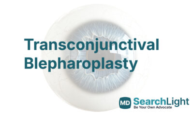 Transconjunctival Blepharoplasty