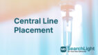 Central Line Placement