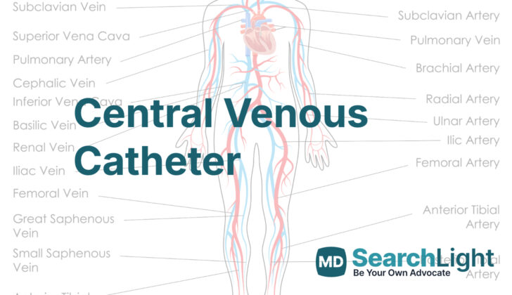 Central Venous Catheter