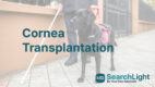 Cornea Transplantation
